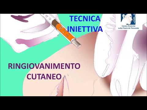 Cliniche migliori sostituzione dellarticolazione Il trattamento della colonna vertebrale in Mari El