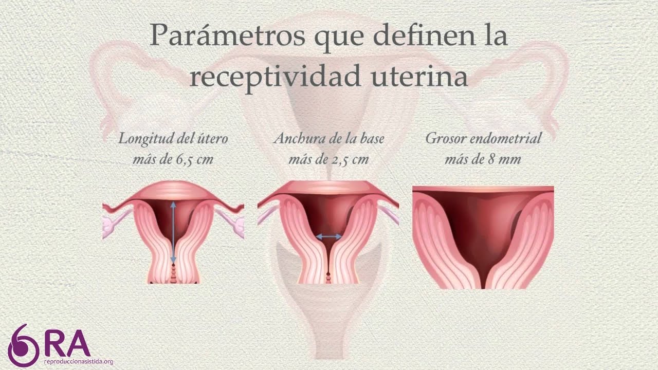 ¿Qué prueba se requiere para ver el grosor endometrial?