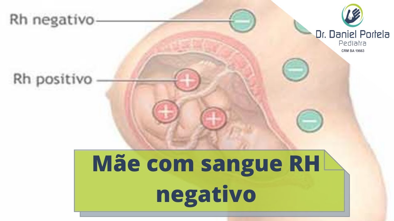 Mãe com sangue Negativo