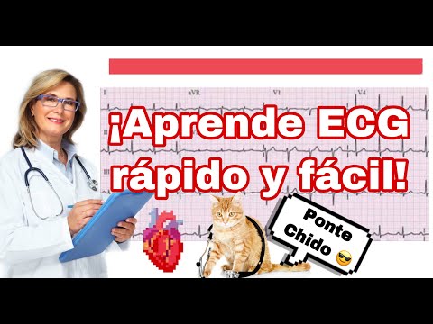¡ECG TODO LO QUE HAY QUE SABER!