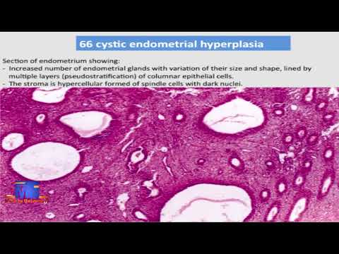 MED Level2 REB221 Practical Pathology Diseases of Female Genital System  24 2 2021