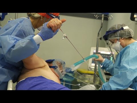 Intubationen: Zuspitzung auf italienischen Intensivstationen