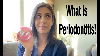 How To Prevent Gum Disease! | What Is Periodontitis?