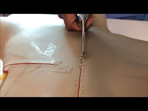 HOW TO REMOVE SURGICAL STAPLES & SUTURES!!