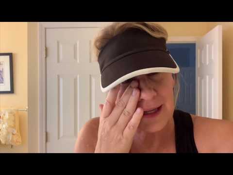 TMI GRAPHIC - INVERTED PAPILLOMA | SURGERY RECOVERY