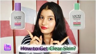 Get Clear Skin with Lacto Calamine Lotion || Remove Acne Scars &amp; Pigmentation Easily || Riya Beauty