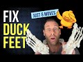 Fix Duck Feet With Just 5 Easy Moves