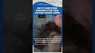 Viral Kisah Bayi Umur 2 Hari Terkena Penyakit Radang Otak Gegara Dicium Orang 'Pembawa' Virus Herpes