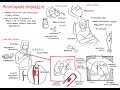 Pulmonary Embolism Overview