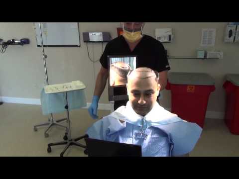 Dr. Brett Bolton Patient Amir Suture Line  Part #3