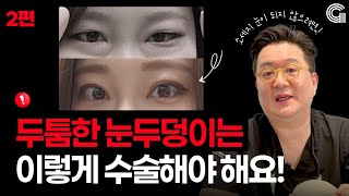 두툼한 눈두덩이는 이렇게 수술해야 해요!