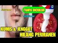 TIPS MENGHILANGKAN KUMIS TANPA DICUKUR HOW TO REMOVE Mustache WITHOUT CHEATING