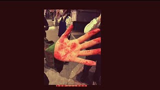 Cover art for 鮮血A子ちゃん 障害です。(shogaidesu)