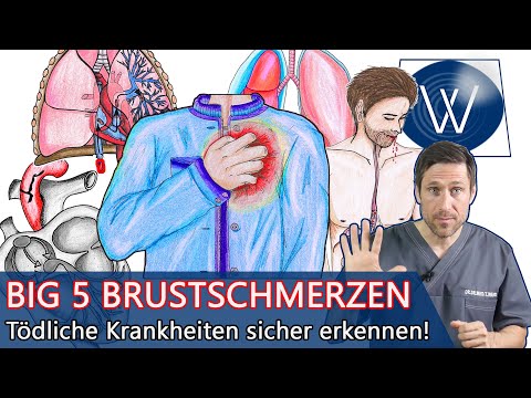 Brustschmerzen - Die Big 5: Die schlimmsten Ursachen & Krankheiten bei Schmerzen in der linken Brust