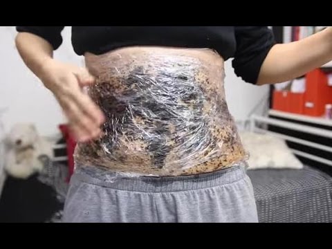 Jika Anda makan nasi satu dapat menurunkan berat badan Hormonal gangguan kelebihan berat badan