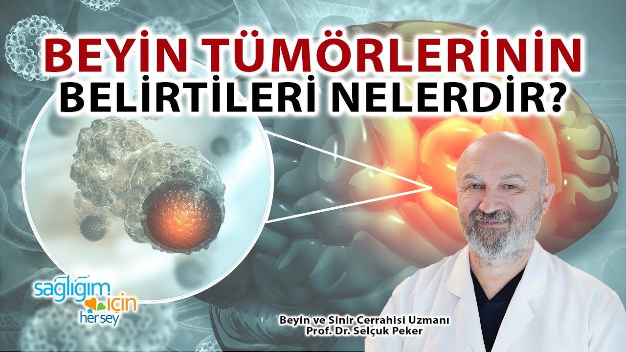 Beyin Tümörlerinin Belirtileri Nelerdir?