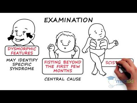 Pediatrics – Hypotonic Infant: By Wendy Stewart M.D.