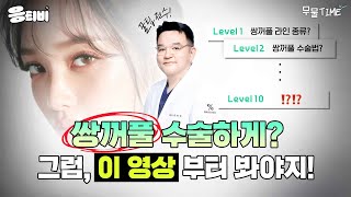 쌍꺼풀 수술 고민 중이신가요?🙄｜눈성형｜윤현준 원장