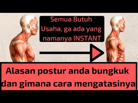download lagu mp3 mp4 Cara Meninggikan Badan Yg Bungkuk, download lagu Cara Meninggikan Badan Yg Bungkuk gratis, unduh video klip Cara Meninggikan Badan Yg Bungkuk