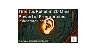Download lagu Instant Tinnitus Relief in 20 Minutes | Soothing Sound Therapy for Ringing Ears | Cure Tinnitus Fast mp3 Download lagu Instant Tinnitus Relief in 20 Minutes | Soothing Sound Therapy for Ringing Ears | Cure Tinnitus Fast mp3