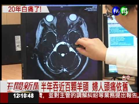 吃頭補頭? 婦吞百顆羊頭治頭痛