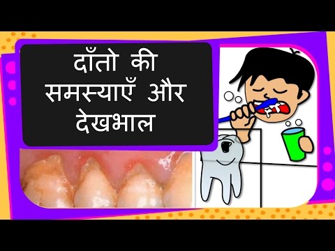 Science - How to take care of teeth, teeth problem and solutions - Hindi