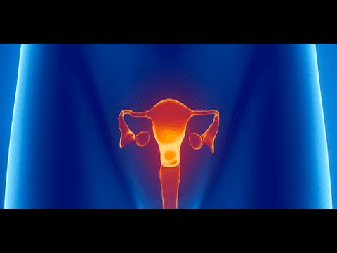 Warum die Schwäche in den Gelenken Hot-Key-Behandlung von Gelenk Bewertungen