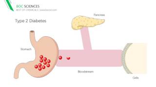 Types and Treatment for Diabetes