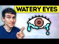 The #1 Best Watery Eyes Remedy (causes and treatment) - Eye Doctor Explains