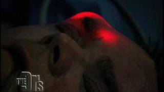 Dr. Paul Nassif Discusses Browlift and Eyelid Lift surgery on The Doctors Television Show