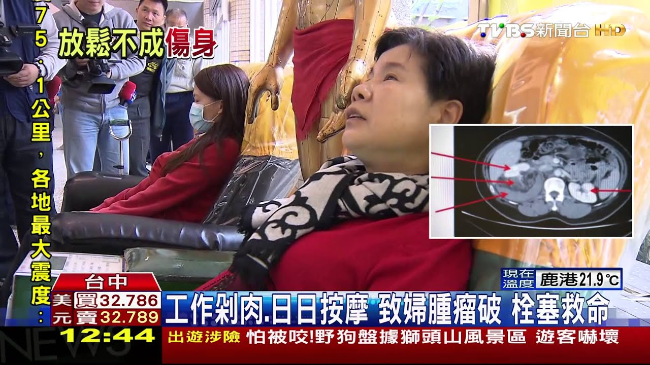 嚇!靠按摩椅紓壓 鵝肉老闆娘腎臟腫瘤破