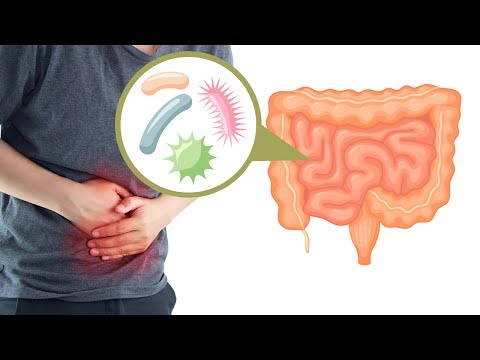 Die Schuppenflechte die Räte des Dermatologen Die Schuppenflechte der Mittelpunkt samara