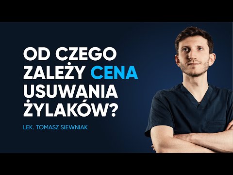 Od czego zależy cena laserowego usuwania żylaków?