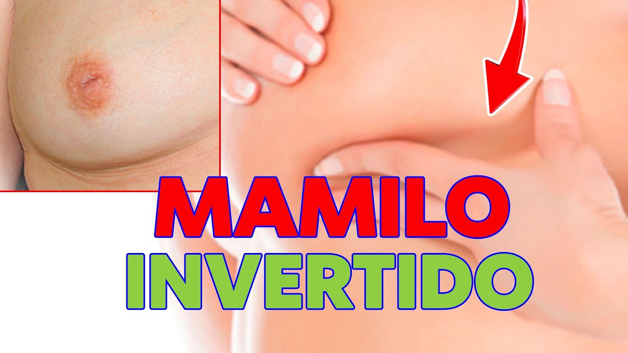MAMILO INVERTIDO OU BICO INVERTIDO O QUE É