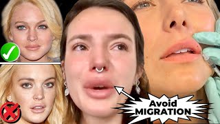 BEFORE YOU GET LIP FILLERS- WATCH THIS- How to Avoid MIGRATION & BOTCHED LIPS