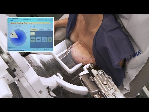 Tomosynthesis Biopsy Clinical Case EnCor and Pristina - BD Europe