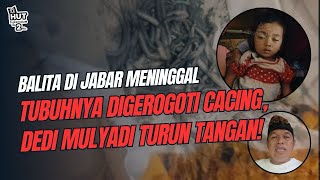 Download lagu Kisah Pilu Raya, Balita di Jabar Meninggal dengan Tubuh Digerogoti Cacing | Ini Kata Dedi Mulyadi! mp3 Download lagu Kisah Pilu Raya, Balita di Jabar Meninggal dengan Tubuh Digerogoti Cacing | Ini Kata Dedi Mulyadi! mp3