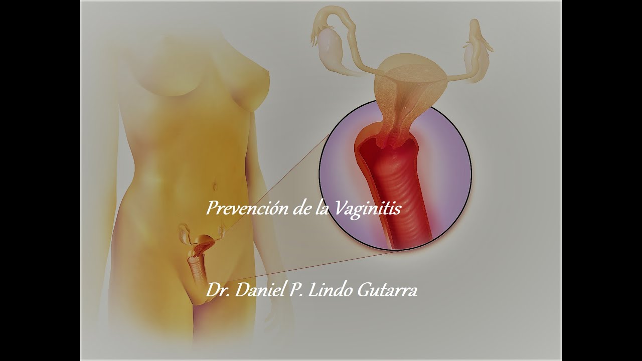 Daniel Paul Lindo Gutarra-21