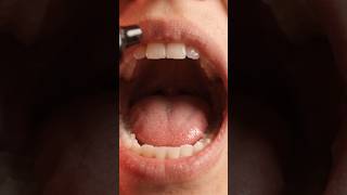 Download lagu What Happens When You Vape? Inside Your Body mp3
