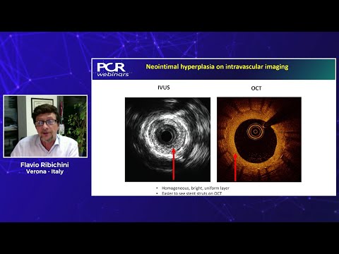 DCB, when and how to use. A discussion with the experts - Webinar