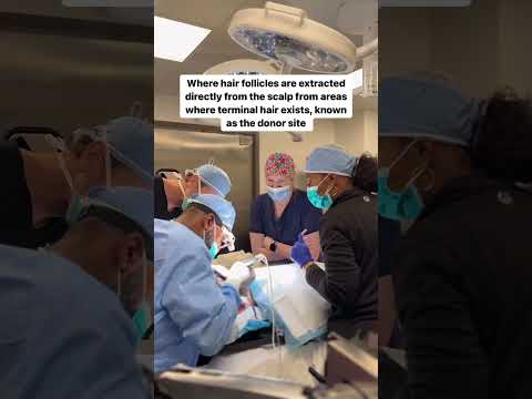 Neograft for hair restoration