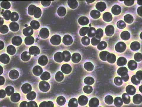 CCC0150092 @ 2015.10.29 before treatment