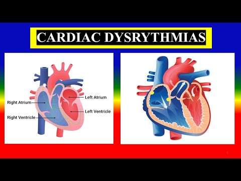 CARDIAC ARRHYTHMIA | DYSRHYTHMIA  - anatomy ,  physiology , Define , Types ,  treatment