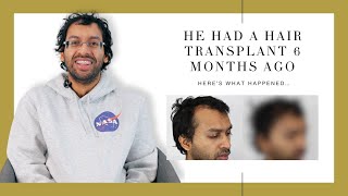 Canadian Hair Transplant Centre