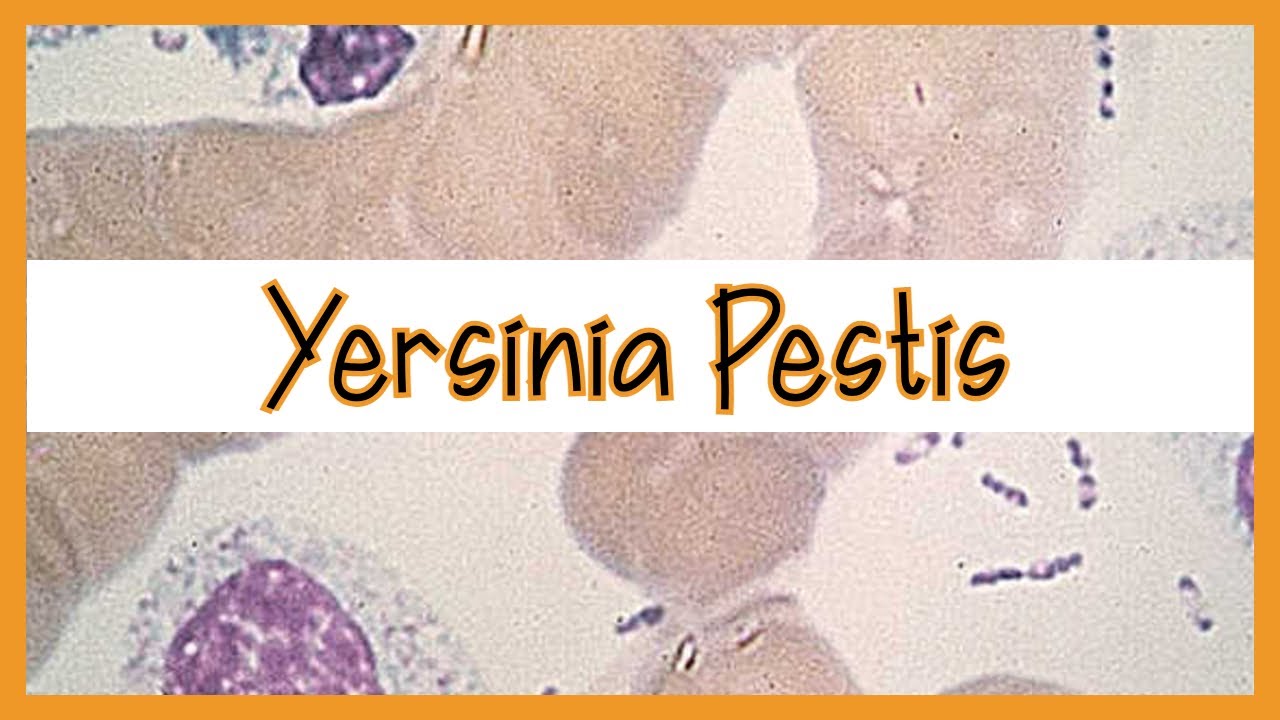 Yersinia Pestis (Plague)