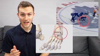Mitch Marner's High Ankle Sprain! Physiotherapist Explains.