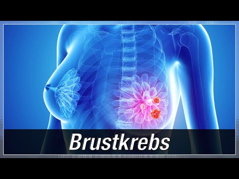 Verfahren zur Herstellung einer hypertonischen Lösung hergestellt werden Hypertonischen Lösung Preis in Moskau