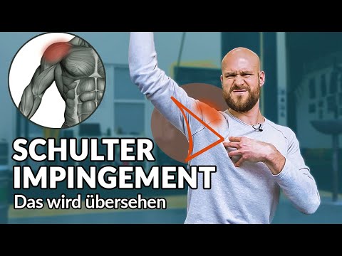 Resolve shoulder impingement - Don't make this mistake and free yourself (+exercise)