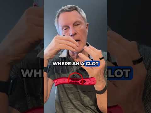 Why Aspirin Cleans Arteries