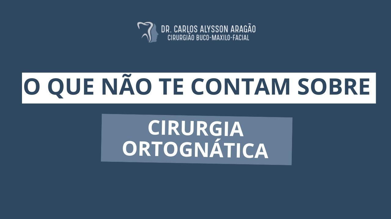 Carlos Alysson Aragão-40